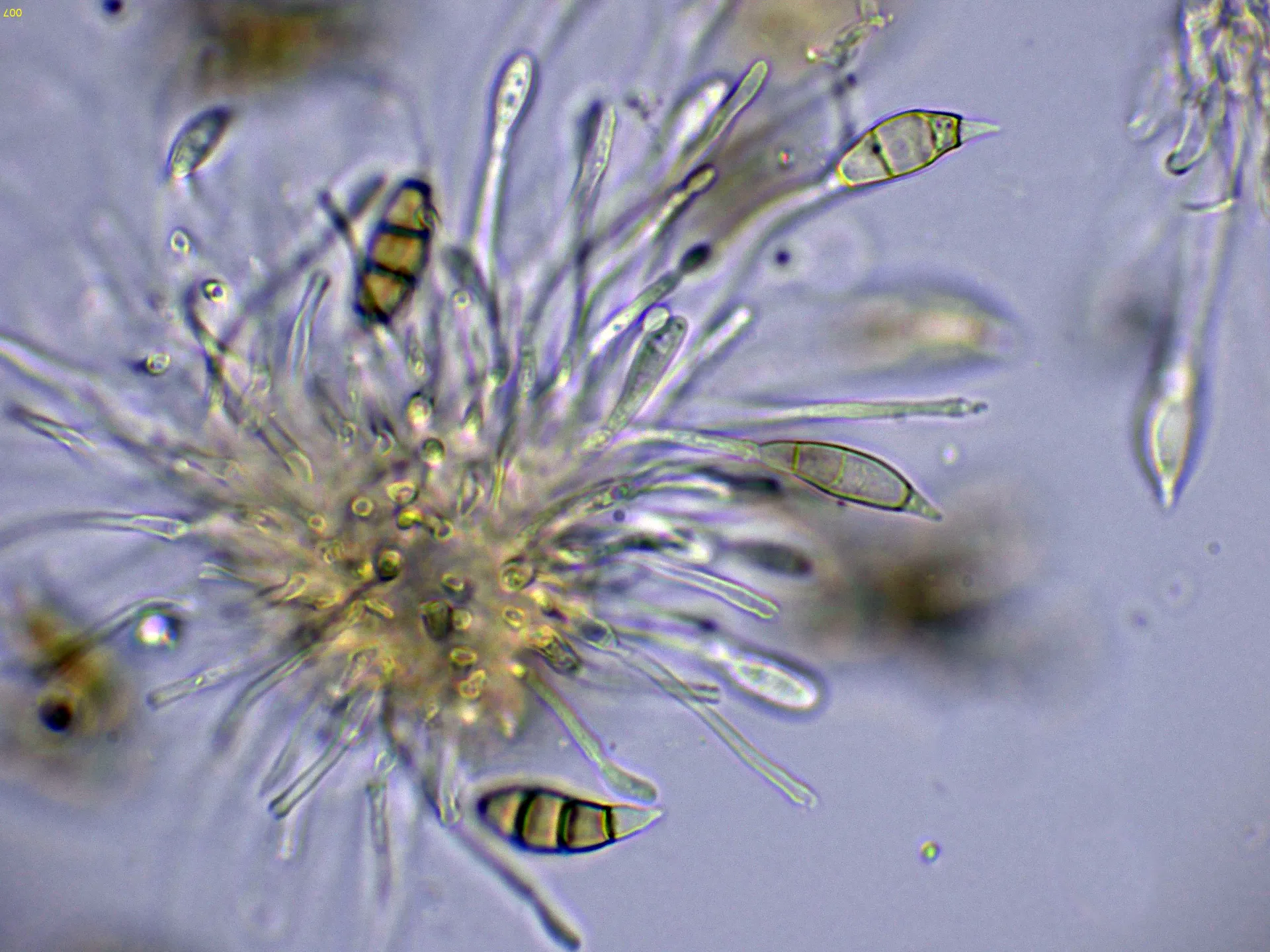 Microscopía de Monochaetia monochaeta - 10 - Hifas conidiógenas agua-007